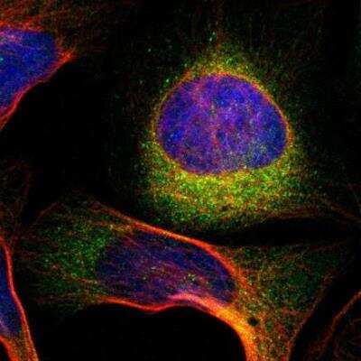 Immunocytochemistry/ Immunofluorescence: TMEM125 Antibody [NBP1-81186]