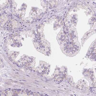Immunohistochemistry-Paraffin: TMEM130 Antibody [NBP1-84099]