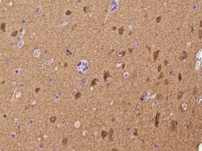 Immunohistochemistry-Paraffin: TMEM132A Antibody [NBP2-97863]
