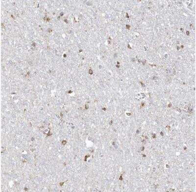 Immunohistochemistry-Paraffin: TMEM132B Antibody [NBP1-93575]