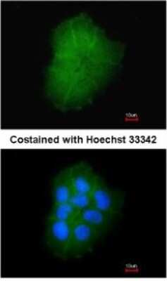 Immunocytochemistry/ Immunofluorescence: TMEM147 Antibody [NBP1-32112]