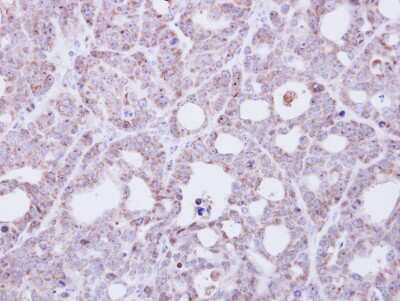Immunohistochemistry-Paraffin: TMEM147 Antibody [NBP1-32112]