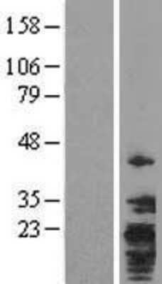 Western Blot: TMEM147 Overexpression Lysate [NBL1-17019]