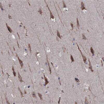 Immunohistochemistry-Paraffin: TMEM151A Antibody [NBP1-81115]