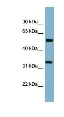Western Blot: TMEM158 Antibody [NBP1-91300]