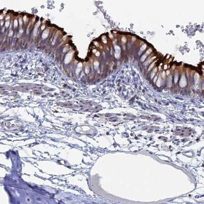 Immunohistochemistry-Paraffin: TMEM161A Antibody [NBP1-93975]