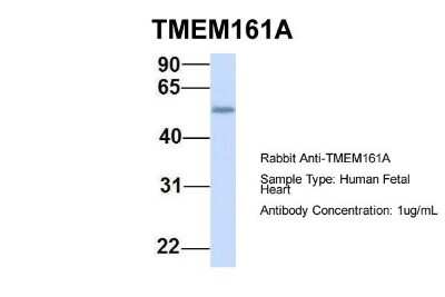 Western Blot: TMEM161A Antibody [NBP1-91304]