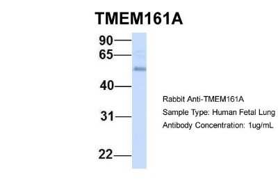 Western Blot: TMEM161A Antibody [NBP1-91304]