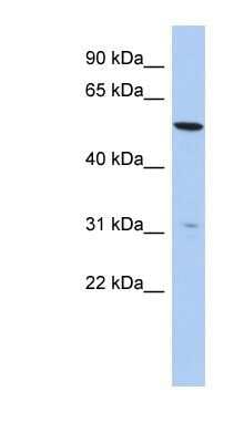 Western Blot: TMEM161B Antibody [NBP1-91442]