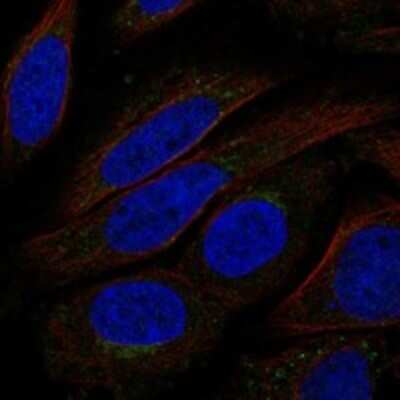 Immunocytochemistry/ Immunofluorescence: TMEM168 Antibody [NBP3-17321]