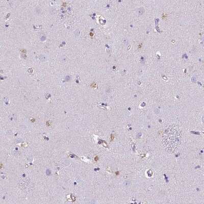 Immunohistochemistry-Paraffin: TMEM169 Antibody [NBP2-49642]
