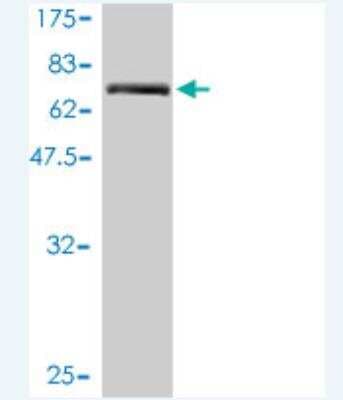Western Blot: TMEM16K Antibody (2B12-1A11) [H00055129-M01]