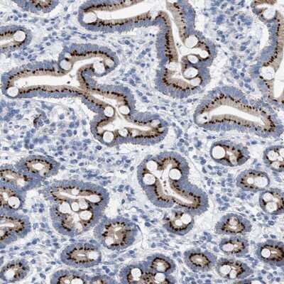 Immunohistochemistry-Paraffin: TMEM17 Antibody [NBP1-81974]