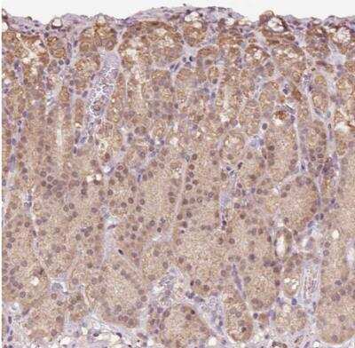 Immunohistochemistry-Paraffin: TMEM170B Antibody [NBP2-33739]