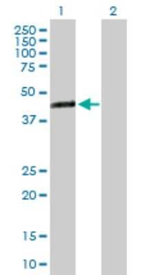 Western Blot: TMEM171 Antibody [H00134285-B01P]