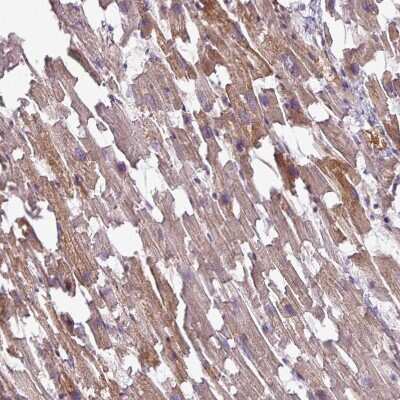 Immunohistochemistry-Paraffin: TMEM178B Antibody [NBP2-14656]