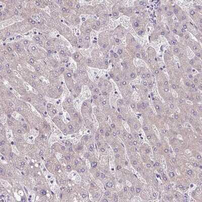 Immunohistochemistry-Paraffin: TMEM178B Antibody [NBP2-14656]