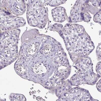 Immunohistochemistry-Paraffin: TMEM178B Antibody [NBP2-14656]
