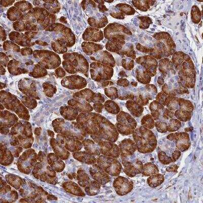 Immunohistochemistry: TMEM18 Antibody [NBP1-90558]