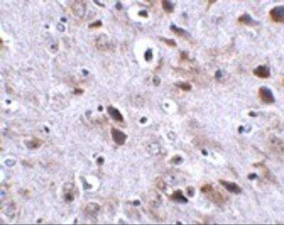 Immunohistochemistry: TMEM18 Antibody - BSA Free [NBP2-81843]