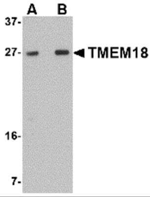 Western Blot: TMEM18 AntibodyBSA Free [NBP2-81843]