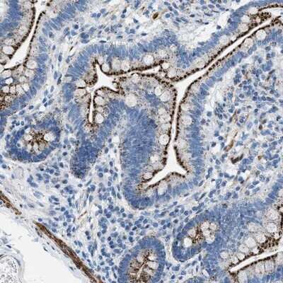 Immunohistochemistry-Paraffin: TMEM180 Antibody [NBP1-90827]