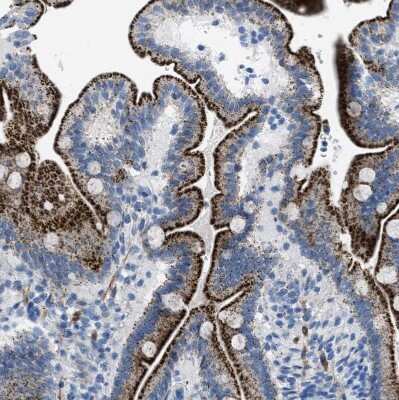 Immunohistochemistry-Paraffin: TMEM180 Antibody [NBP1-90827]