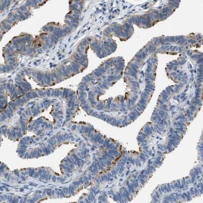 Immunohistochemistry-Paraffin: TMEM180 Antibody [NBP1-90827]