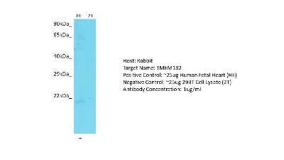 Western Blot: TMEM182 Antibody [NBP2-83681]