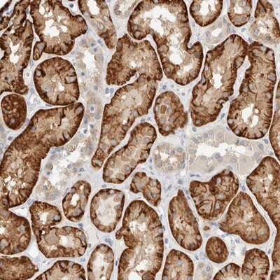 Immunohistochemistry-Paraffin: TMEM184B Antibody [NBP1-86810]