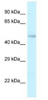 Western Blot: TMEM184B Antibody [NBP1-79196]