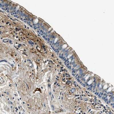 Immunohistochemistry-Paraffin: TMEM186 Antibody [NBP1-88452]
