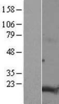 Western Blot: TMEM188 Overexpression Lysate [NBL1-17050]
