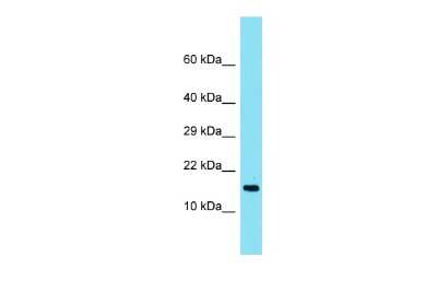 Western Blot: TMEM190 Antibody [NBP3-09652]