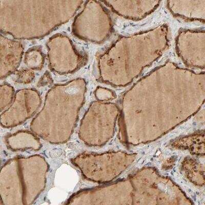 Immunohistochemistry: TMEM192 Antibody [NBP1-93799]