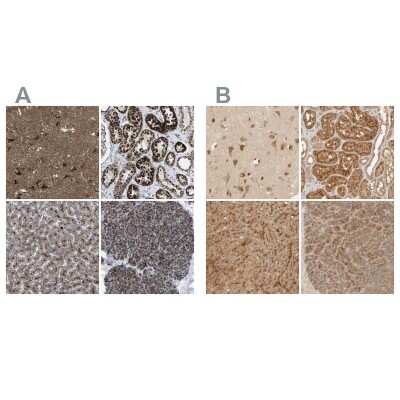 Immunohistochemistry-Paraffin: TMEM192 Antibody [NBP1-93798]
