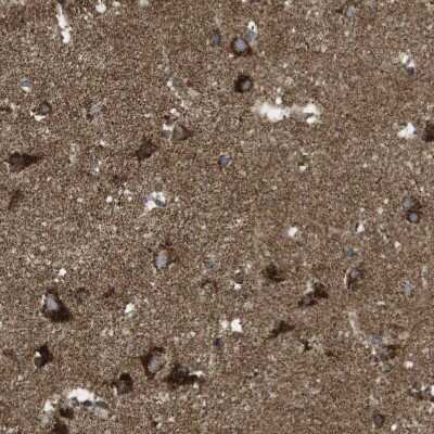 Immunohistochemistry-Paraffin: TMEM192 Antibody [NBP1-93798]