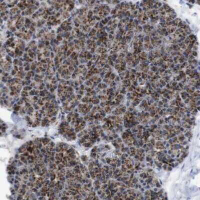 Immunohistochemistry-Paraffin: TMEM192 Antibody [NBP1-93798]