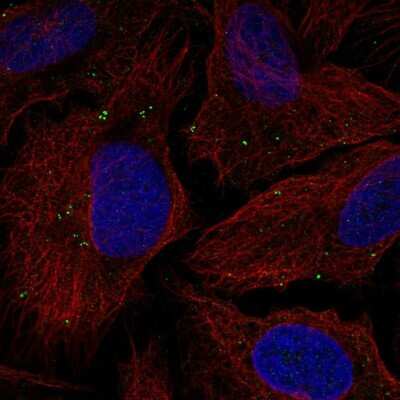 Immunocytochemistry/ Immunofluorescence: TMEM198 Antibody [NBP2-59008]