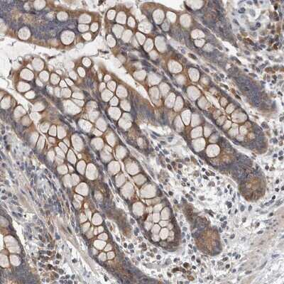 Immunohistochemistry-Paraffin: TMEM199 Antibody [NBP1-88467]