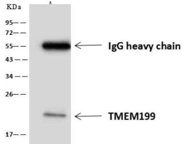 Immunoprecipitation: TMEM199 Antibody [NBP3-06494]