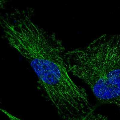 Immunocytochemistry/ Immunofluorescence: TMEM200C Antibody [NBP2-30838]