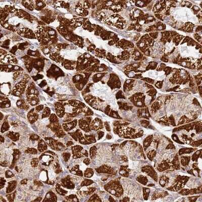 Immunohistochemistry-Paraffin: TMEM200C Antibody [NBP2-30838]