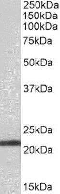 Western Blot: TMEM205 Antibody [NBP1-52110]