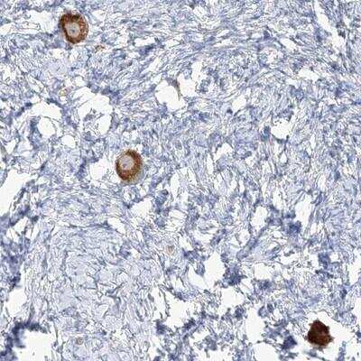 Immunohistochemistry: TMEM209 Antibody [NBP1-94004]