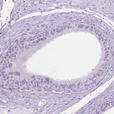 Immunohistochemistry-Paraffin: TMEM210 Antibody [NBP2-49498]