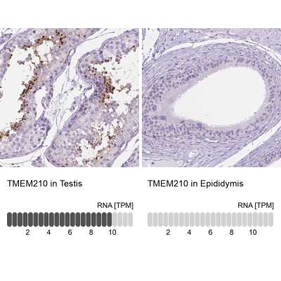 Immunohistochemistry-Paraffin: TMEM210 Antibody [NBP2-49498]