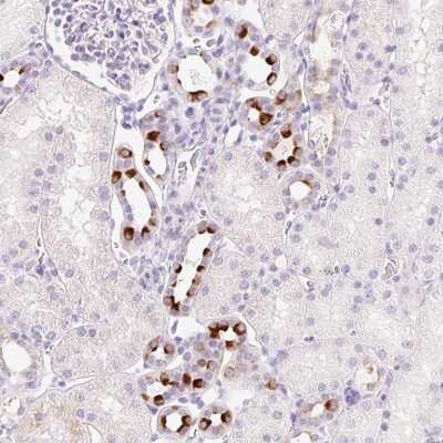 Immunohistochemistry-Paraffin: TMEM213 Antibody [NBP2-30616]