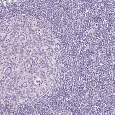 Immunohistochemistry-Paraffin: TMEM213 Antibody [NBP2-30616]