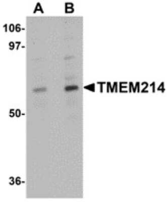 Western Blot: TMEM214 AntibodyBSA Free [NBP2-82033]